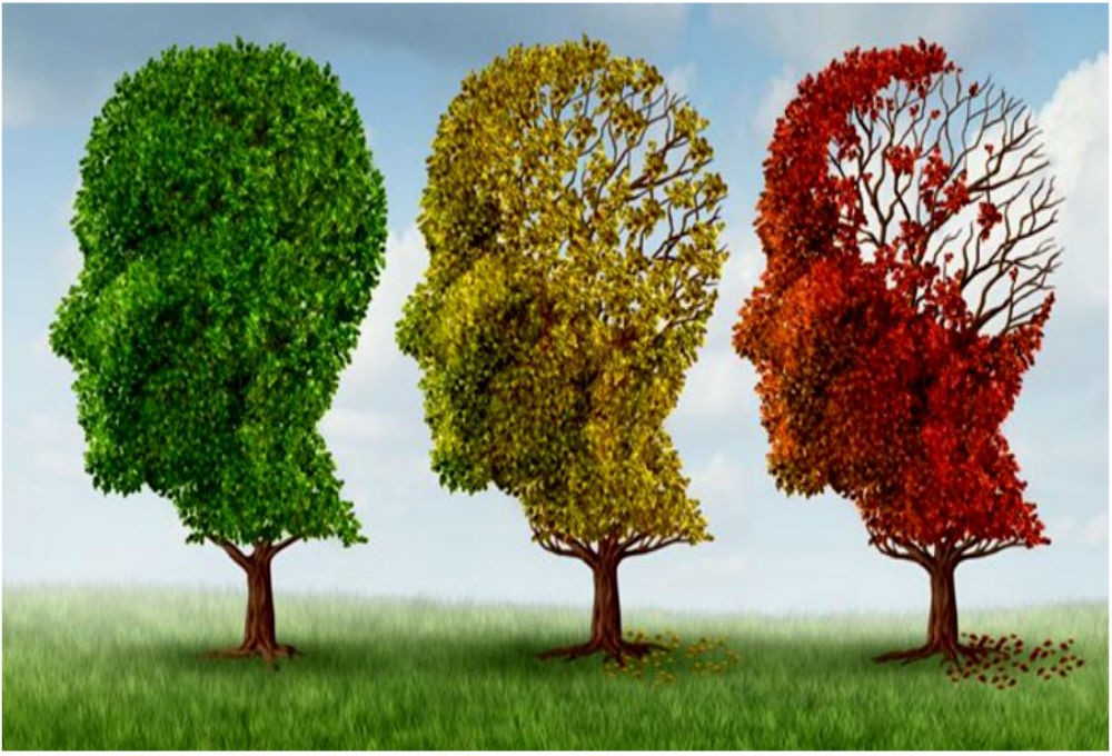 Doença de Alzheimer é uma psicopatologia crônico-degenerativa, podendo e devendo ser tratada